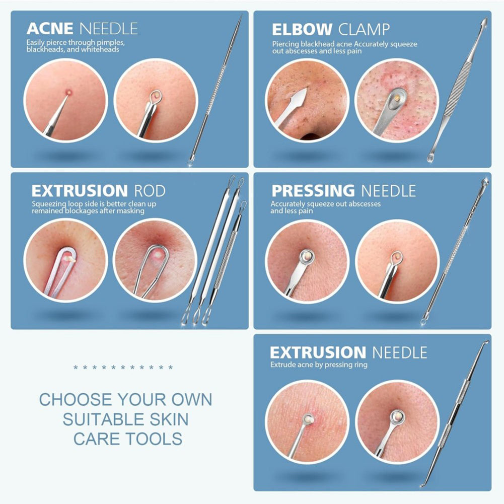 5-Pieces Set- BlackHead Remover Kit Pimple Comedone Extractor Tool Set