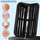 5-Pieces Set- BlackHead Remover Kit Pimple Comedone Extractor Tool Set