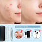 5-Pieces Set- BlackHead Remover Kit Pimple Comedone Extractor Tool Set