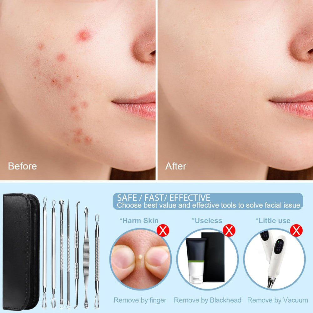 5-Pieces Set- BlackHead Remover Kit Pimple Comedone Extractor Tool Set